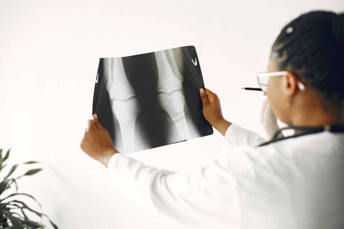 Clinician reviewing a knee X-ray during diagnostic imaging at Regenerative Joint Clinics
